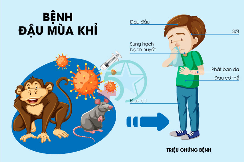 Trieu-chung-benh-dau-mua-khi-f